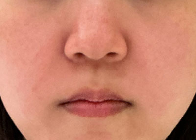 After