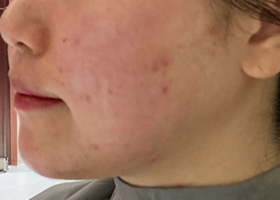 After