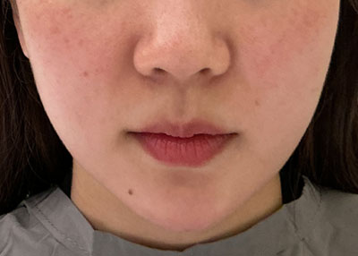 After