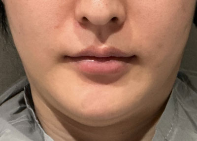 Before