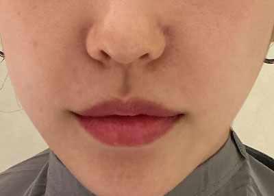 Before