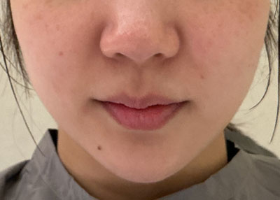 Before